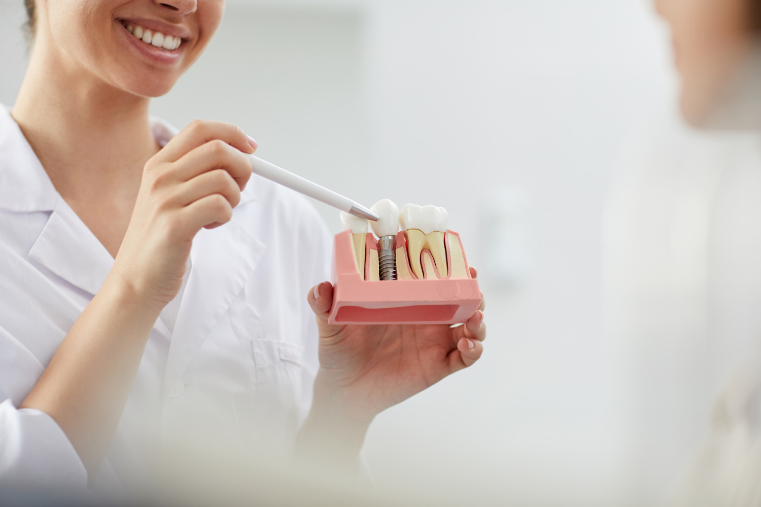 implante dental